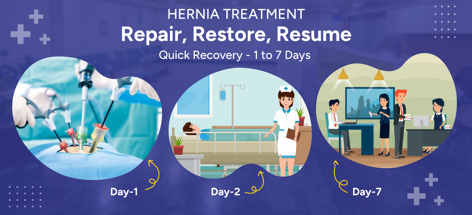 Best Hernia Surgery